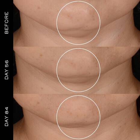 RENERGIE H.P.N. 300-PEPTIDE & REFILL DUO