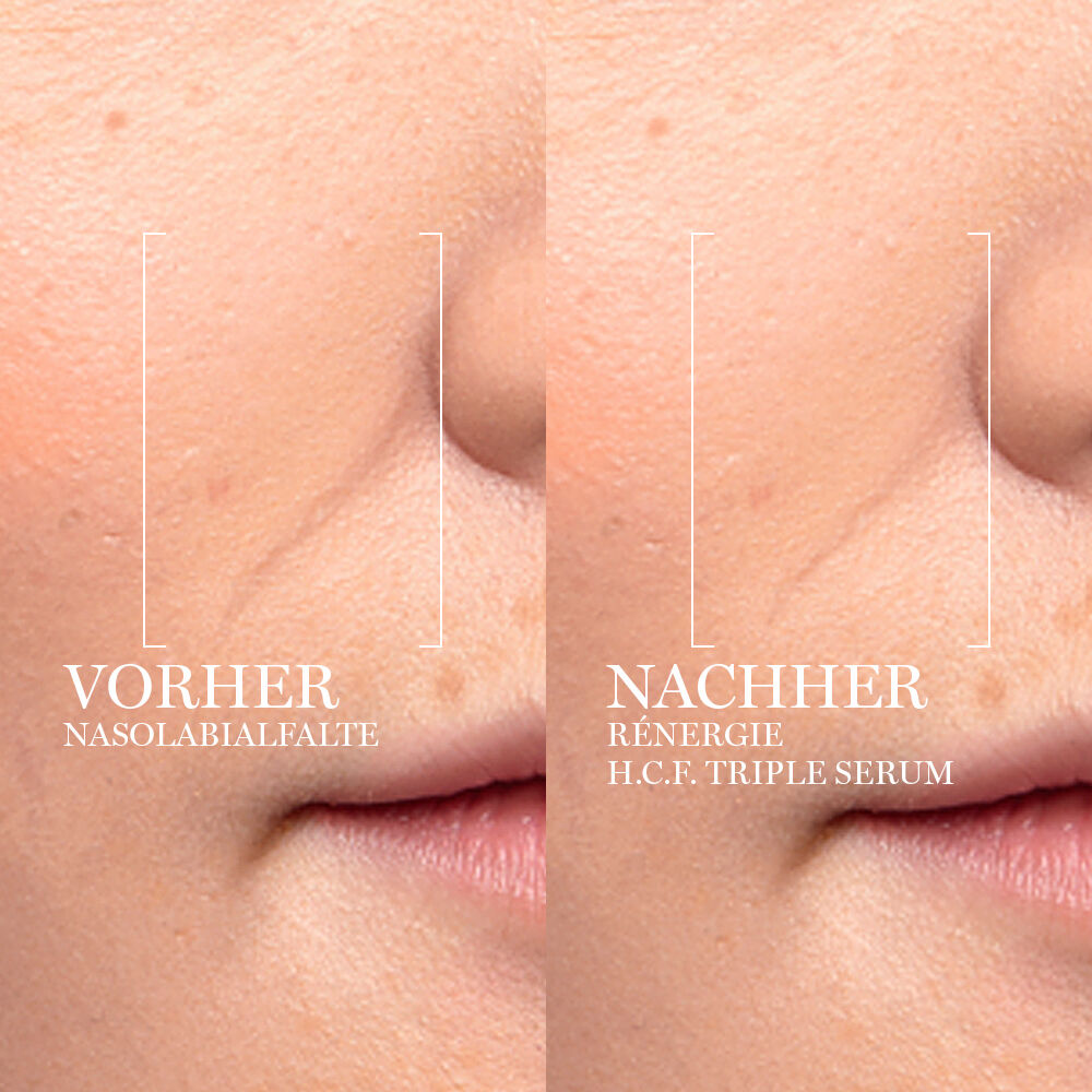Renergie H.C.F. Triple Serum Vorher Nachher