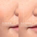 Renergie H.C.F. Triple Serum Vorher Nachher