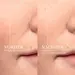 Renergie H.C.F. Triple Serum Vorher Nachher