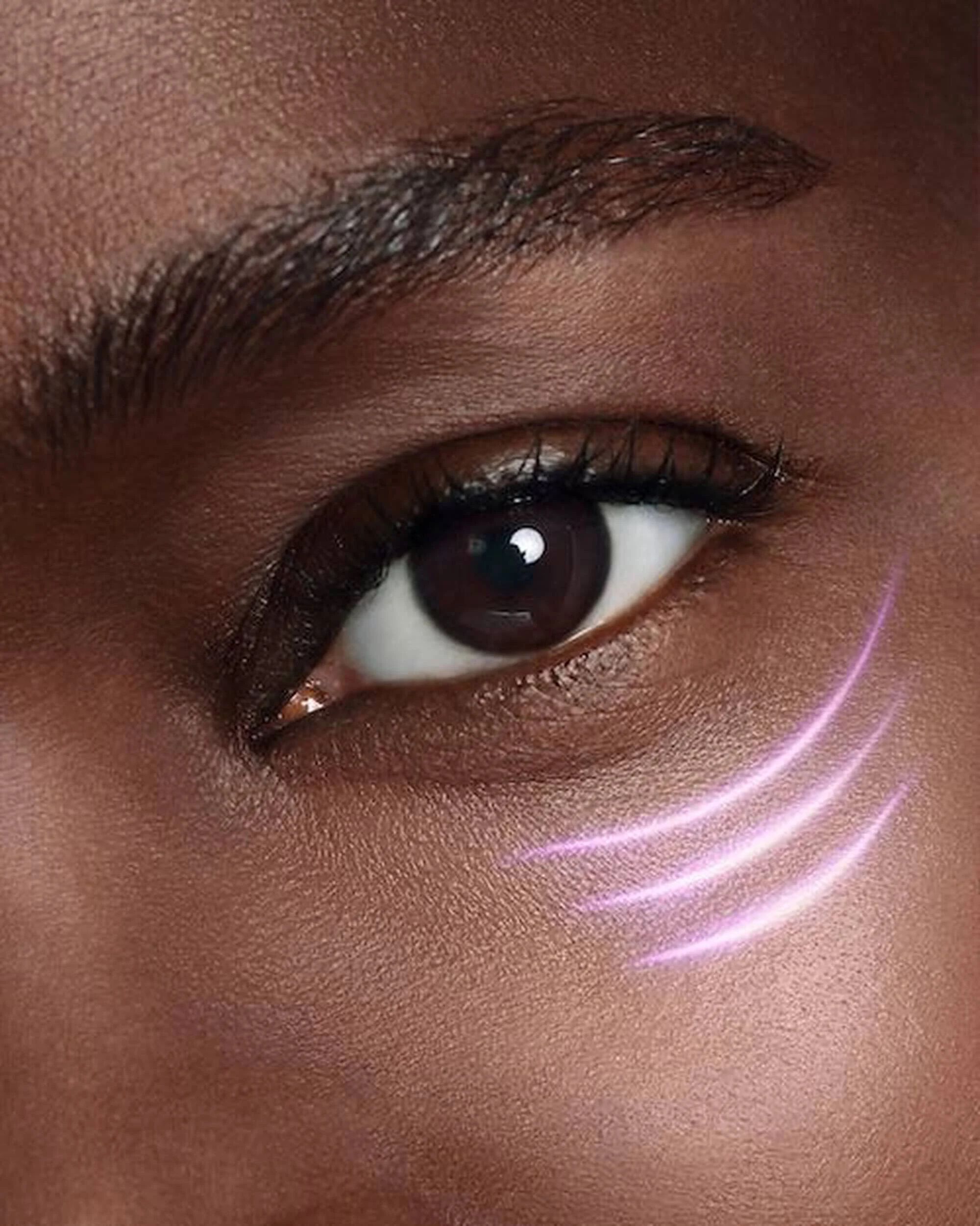 Dark Circles Illustration