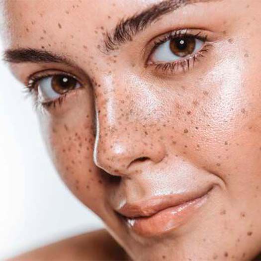 Große Poren verkleinern