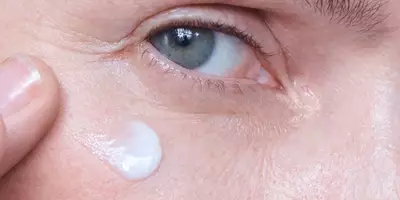 Augenfalte wird mit Hyaluron-Creme behandelt