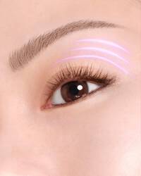Puffiness Illustration