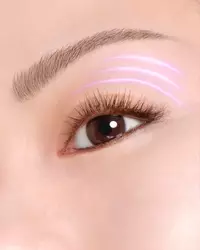 Puffiness Illustration