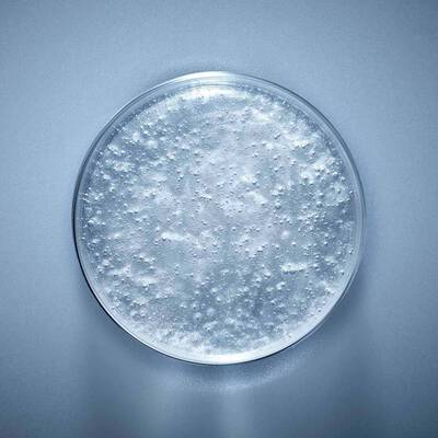 Nahaufnahme von Hyaluronsaure in einer transparenten Petrischale mit gelartiger, leicht schimmernder Textur auf grauem Hintergrund.